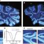 Using polarization to improve quantum imaging